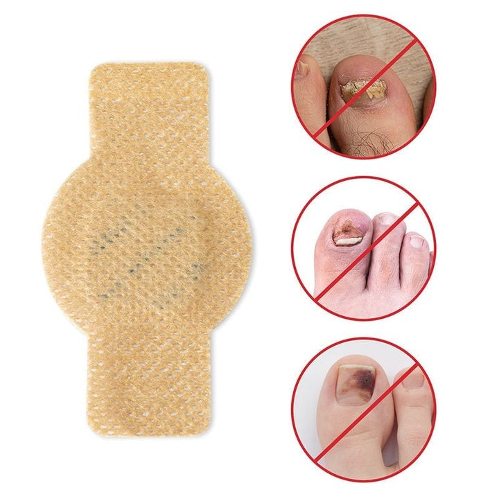 FungalPatch – Antibacterial Antifungal Patch and Nail Care Pack