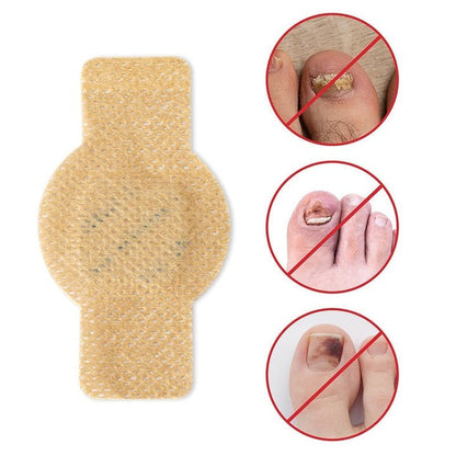 FungalPatch – Antibacterial Antifungal Patch and Nail Care Pack