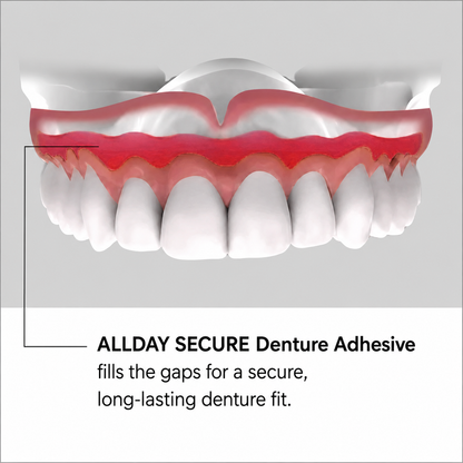 Allday Secure Denture Adhesive