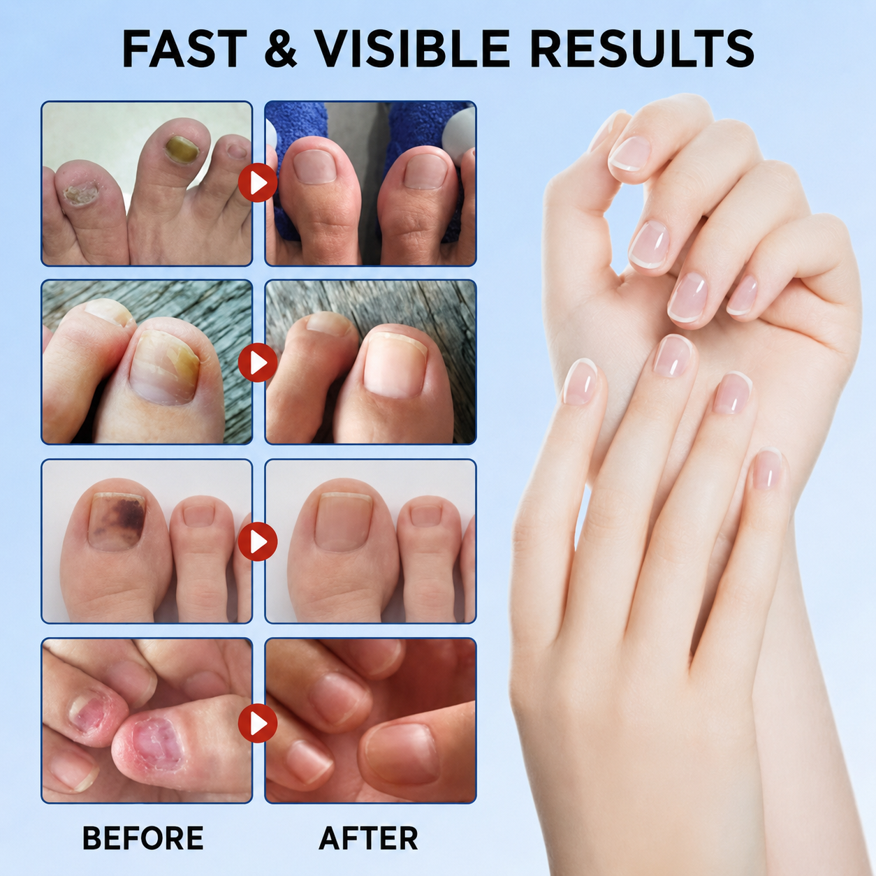 FungalPatch – Antibacterial Antifungal Patch and Nail Care Pack