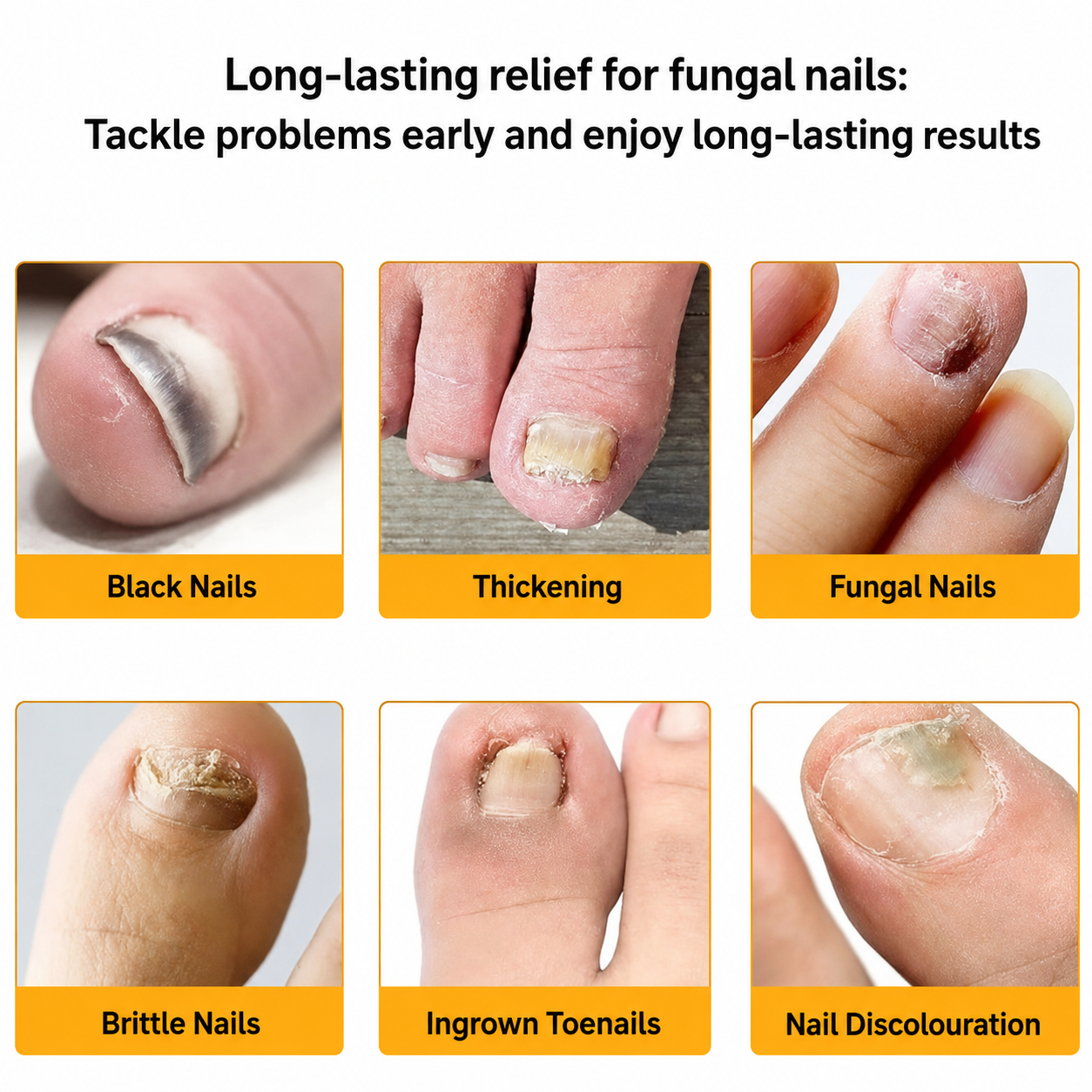 FungalPatch – Antibacterial Antifungal Patch and Nail Care Pack