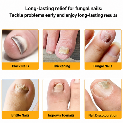 FungalPatch – Antibacterial Antifungal Patch and Nail Care Pack