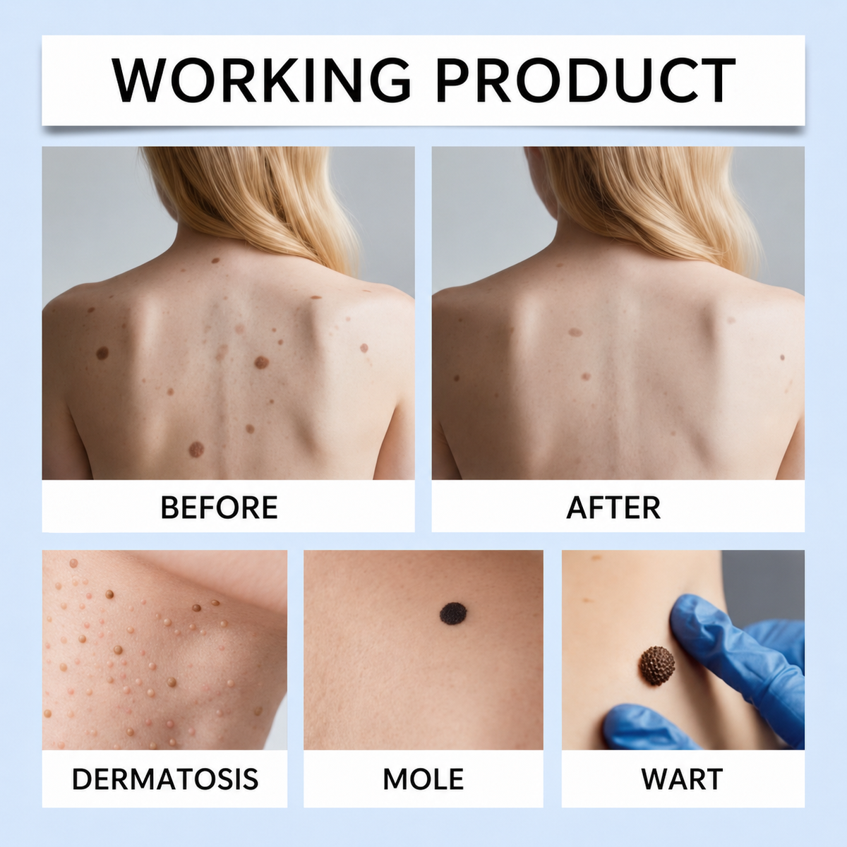 ClearRoller™ Roller Serum – Advanced for Clear Skin
